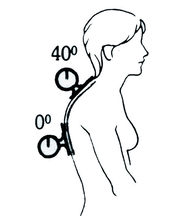Angle tool Anatomic SITT AB